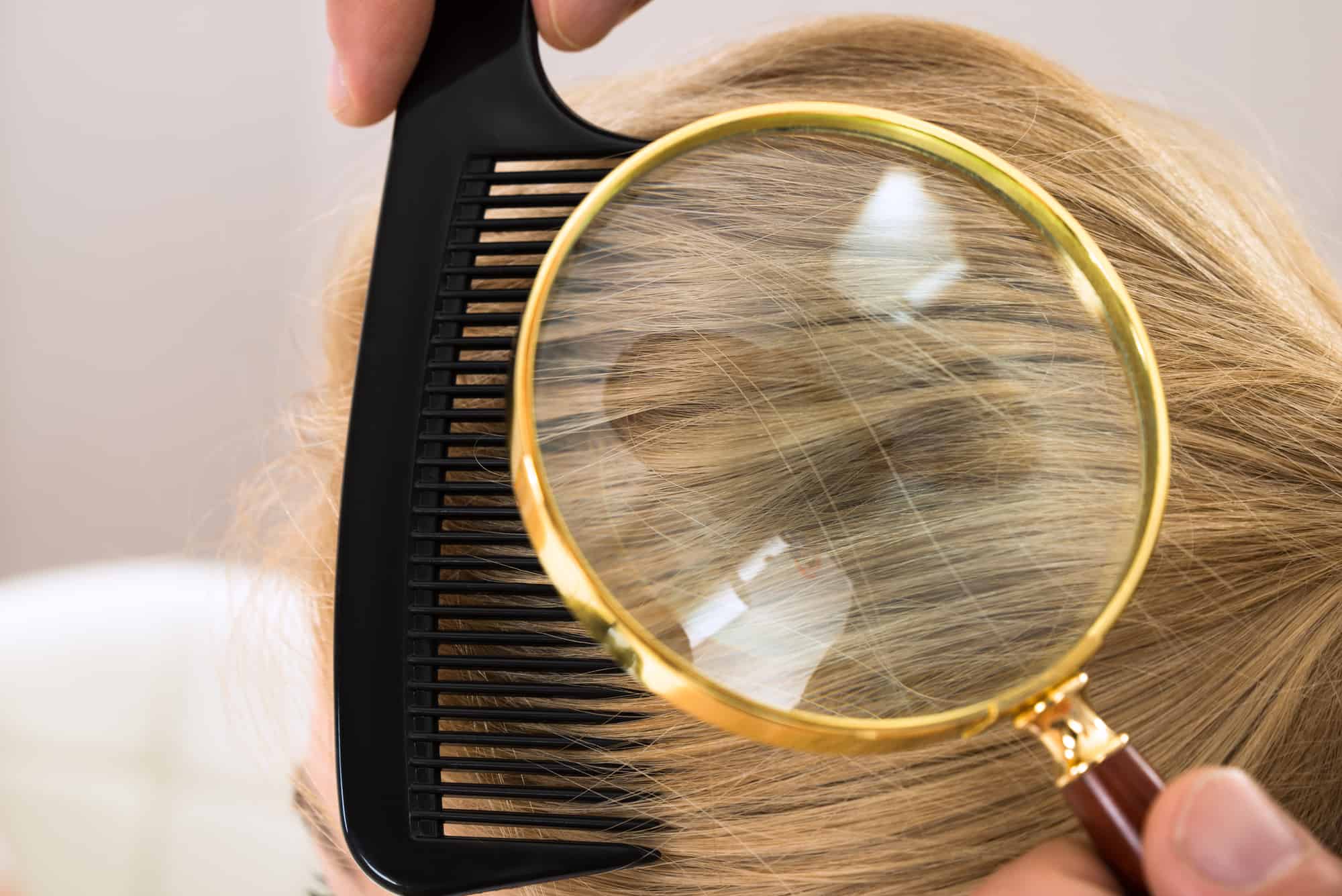 Close-up Dermatologist Looking At Patient's Blonde Hair Through Magnifying Glass